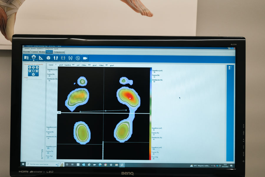 Podólogo deportivo en Deusto 1